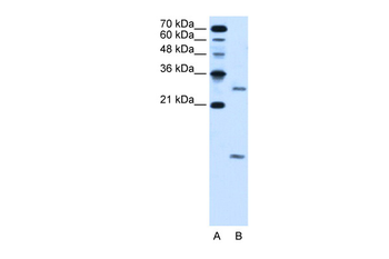 VMA21 Rabbit Polyclonal Antibody