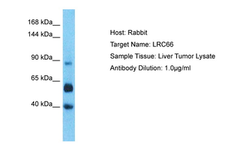 LRRC66 Rabbit Polyclonal Antibody