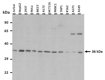 RCE1 Rabbit Polyclonal Antibody