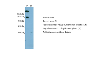 SI Rabbit Polyclonal Antibody