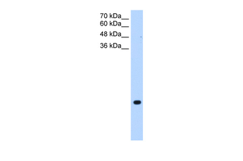 TMEM75 Rabbit Polyclonal Antibody