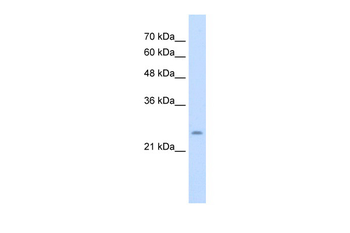 CHIC1 Rabbit Polyclonal Antibody