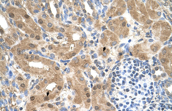 MGC39633 Rabbit Polyclonal Antibody