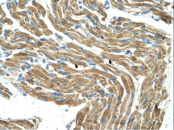 HAL Rabbit Polyclonal Antibody