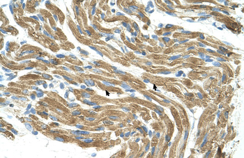 HAL Rabbit Polyclonal Antibody