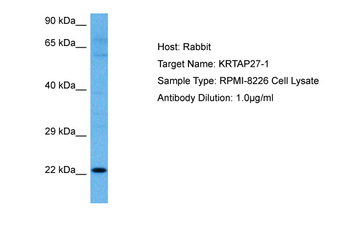 KRTAP27-1 Rabbit Polyclonal Antibody