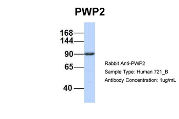 PWP2 Rabbit Polyclonal Antibody