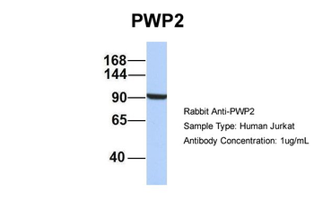 PWP2 Rabbit Polyclonal Antibody