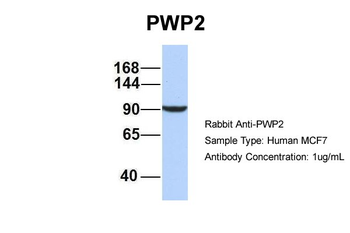 PWP2 Rabbit Polyclonal Antibody