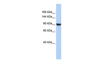 PWP2 Rabbit Polyclonal Antibody