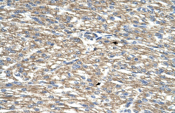 TCP10L Rabbit Polyclonal Antibody
