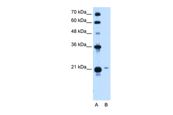 TCP10L Rabbit Polyclonal Antibody