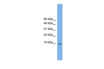 KRTAP23-1 Rabbit Polyclonal Antibody