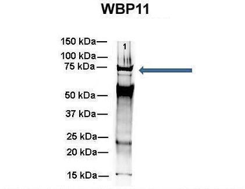 WBP11 Rabbit Polyclonal Antibody