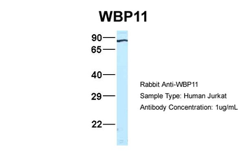 WBP11 Rabbit Polyclonal Antibody