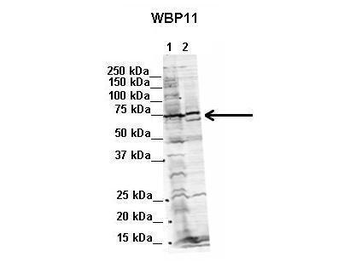 WBP11 Rabbit Polyclonal Antibody