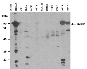 TMEM48 Rabbit Polyclonal Antibody