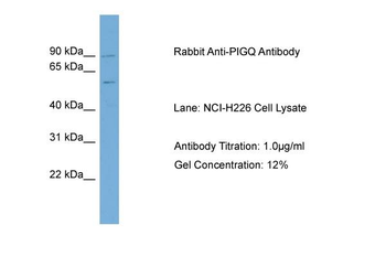 PIGQ Rabbit Polyclonal Antibody