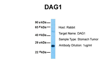DAG1 Rabbit Polyclonal Antibody