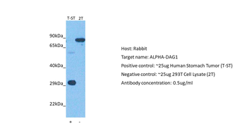 DAG1 Rabbit Polyclonal Antibody