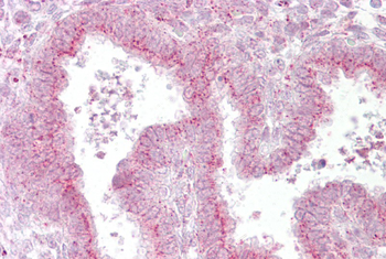 GOLGB1 Rabbit Polyclonal Antibody