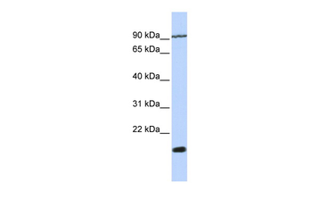 TM4SF4 Rabbit Polyclonal Antibody