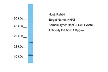 NNAT Rabbit Polyclonal Antibody