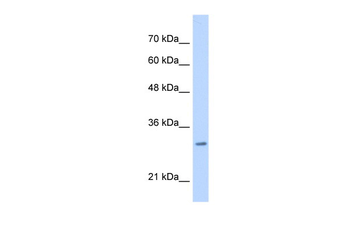 MLF2 Rabbit Polyclonal Antibody