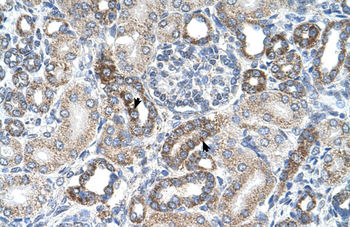 UST Rabbit Polyclonal Antibody