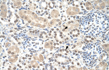 ST8SIA2 Rabbit Polyclonal Antibody