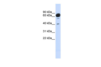 MAN1A2 Rabbit Polyclonal Antibody