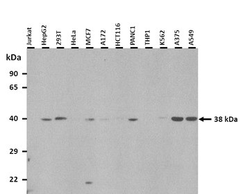 ST6GALNAC6 Rabbit Polyclonal Antibody