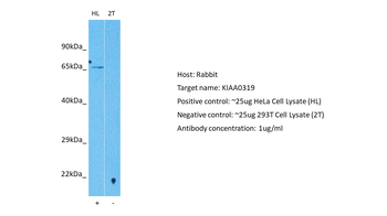KIAA0319 Rabbit Polyclonal Antibody