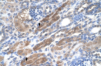 KIAA0319 Rabbit Polyclonal Antibody