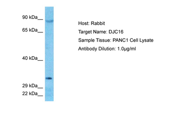 DNAJC16 Rabbit Polyclonal Antibody
