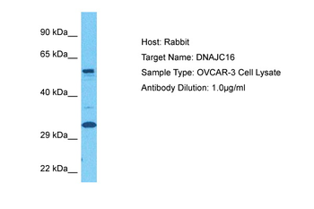 DNAJC16 Rabbit Polyclonal Antibody