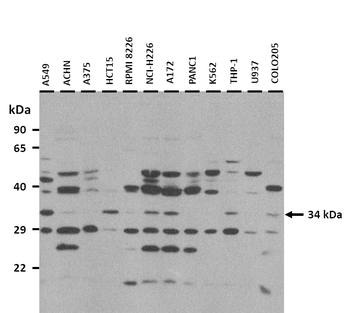 TEX264 Rabbit Polyclonal Antibody