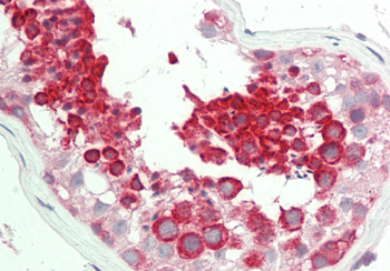 TEX264 Rabbit Polyclonal Antibody