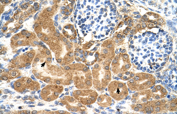 TMEM69 Rabbit Polyclonal Antibody