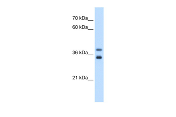GDE1 Rabbit Polyclonal Antibody