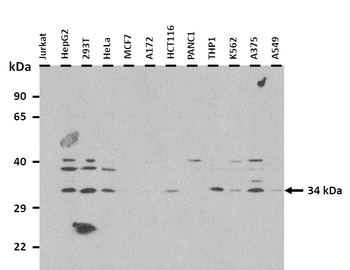 RHBDL2 Rabbit Polyclonal Antibody