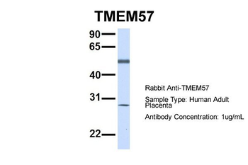 MACO1 Rabbit Polyclonal Antibody