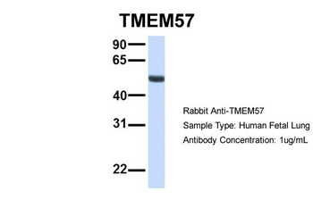 MACO1 Rabbit Polyclonal Antibody