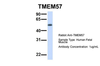 MACO1 Rabbit Polyclonal Antibody