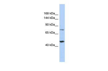 MGA Rabbit Polyclonal Antibody