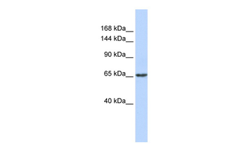 ZNF91 Rabbit Polyclonal Antibody