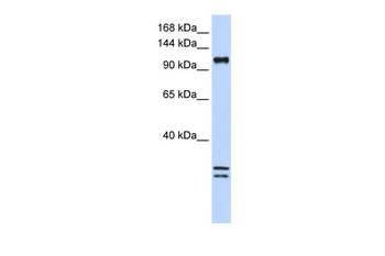 NCKAP1L Rabbit Polyclonal Antibody