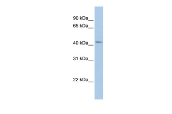 BARHL2 Rabbit Polyclonal Antibody