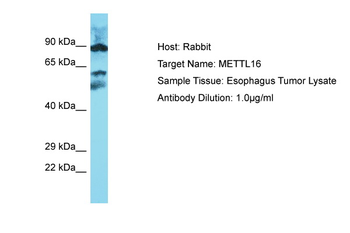METTL16 Rabbit Polyclonal Antibody