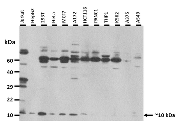 PLAC9 Rabbit Polyclonal Antibody